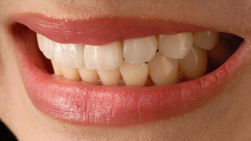 Diş Gıcırdatma Nedir? Diş Gıcırdatmanın Önüne Nasıl Geçilir?