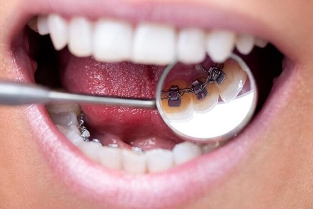 Mecidiyeköy Diş Kliniği tavsiye