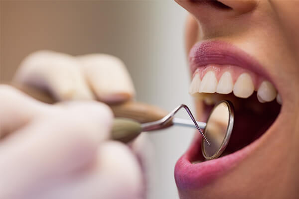 periodontoloji tedavisi avantajları, periodontoloji tedavisi nedir