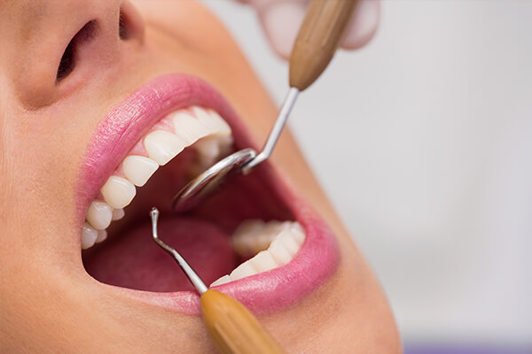 periodontoloji tedavisi durumlari, periodontoloji tedavisi doktoru, periodontoloji tedavisi hekimi, en iyi periodontolojist