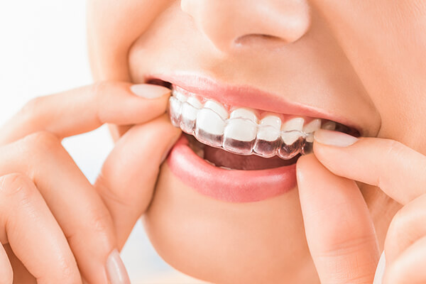 ortodonti tedavisi için amaç, ortodonti tedavisi istanbul, ortodonti tedavisinde hedefler,