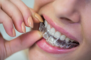 8-maddede-dis-dolgusu-hakkinda-bilmeniz-gereken-her-sey