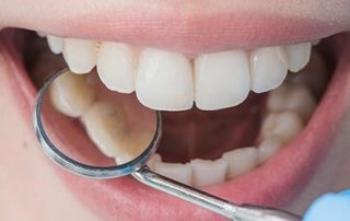 covid-19-agiz-bakimi-blog-icerik-320×202 covid-19-agiz-bakimi-blog-icerik-320x202