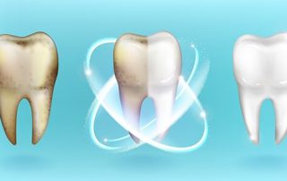 dis-beyazlatmayontemleri-blog-320×202 dis-beyazlatmayontemleri-blog-320x202