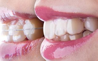 seffaf-plak-blog-icerik-320×202 seffaf-plak-blog-icerik-320x202