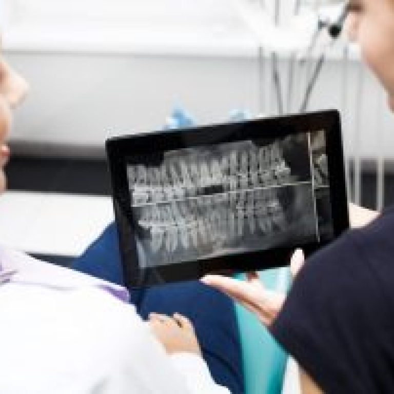 dijital-dis-hekimligi-nedir-320x202