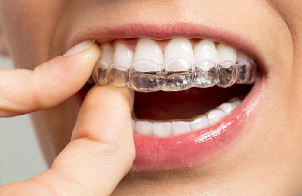 dis-sikma-tedavisi-durumlari dis-sikma-tedavisi-durumlari