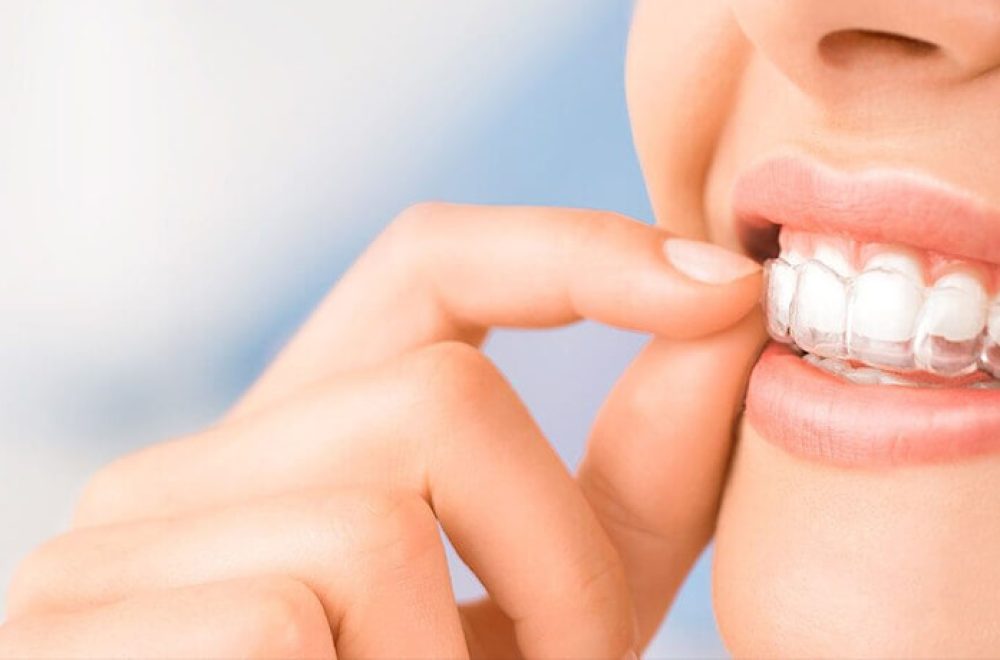 nisantasi-dis-sikma-tedavisi nisantasi-dis-sikma-tedavisi