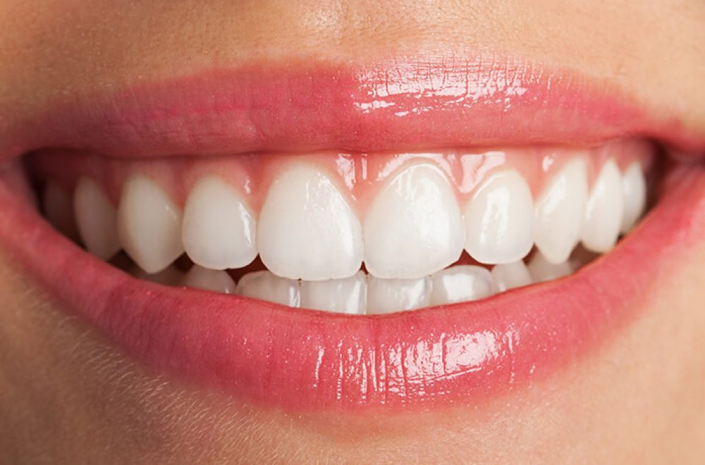 nisantasi-periodontoloji-tedavisi nisantasi-periodontoloji-tedavisi