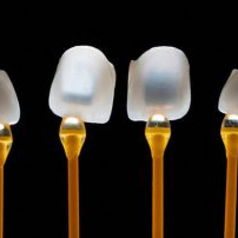 porselen-laminalarin-omru-ne-kadardir-320x202